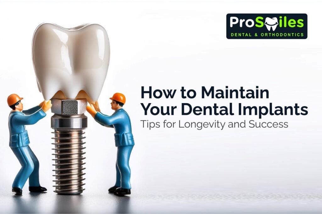 Dental Implants