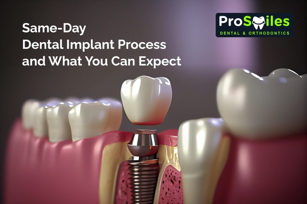 same day dental implants