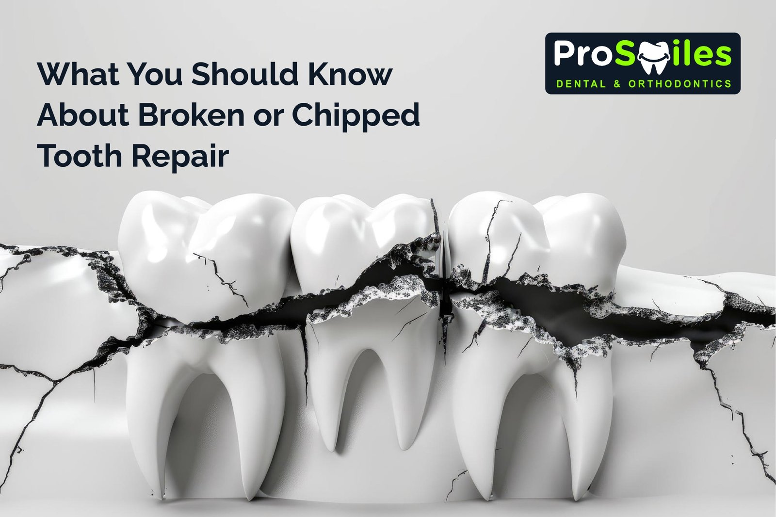 chipped tooth repair