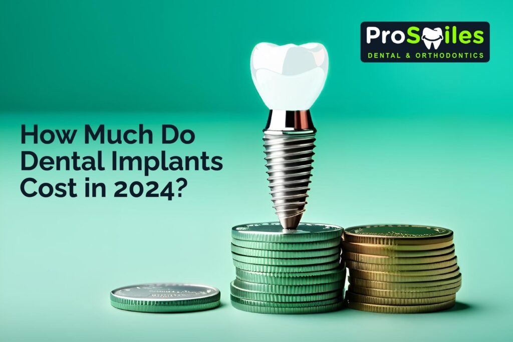 Dental Implants Cost