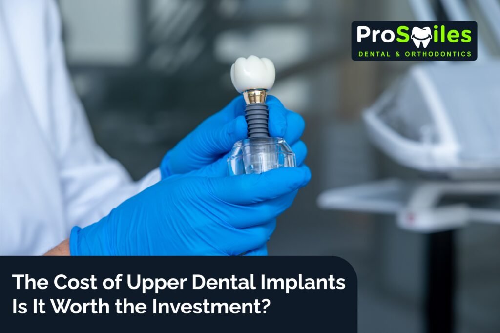 Cost of Upper Dental Implants