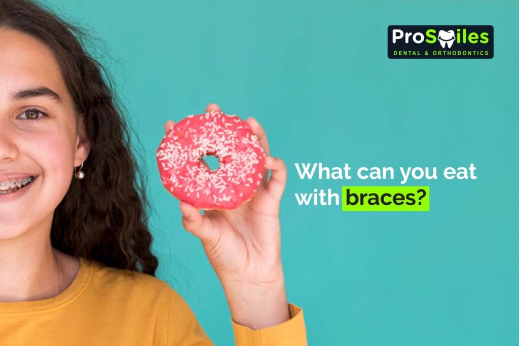 Eat with Braces
