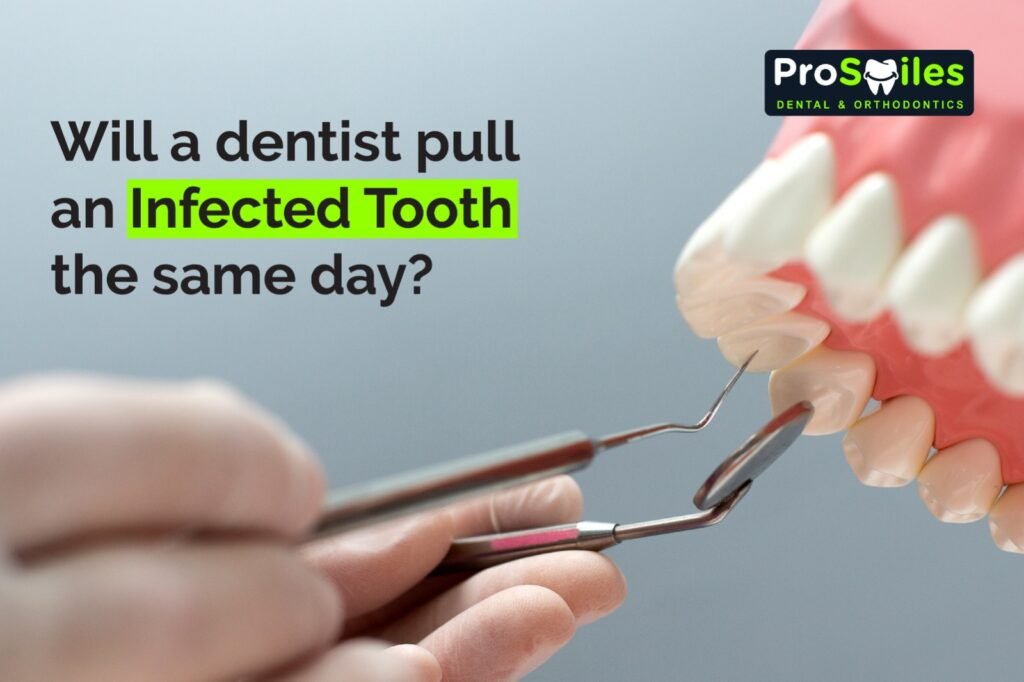 Infected Tooth