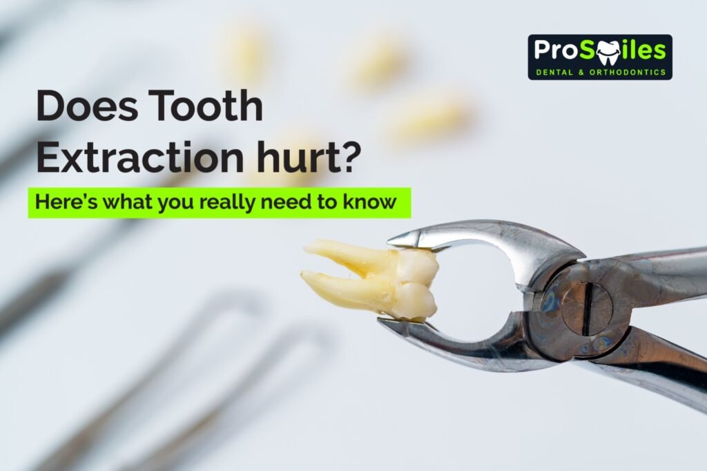 Tooth Extraction Hurt