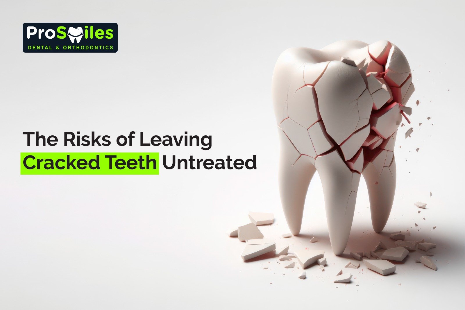 The Risks of Leaving Cracked Teeth Untreated