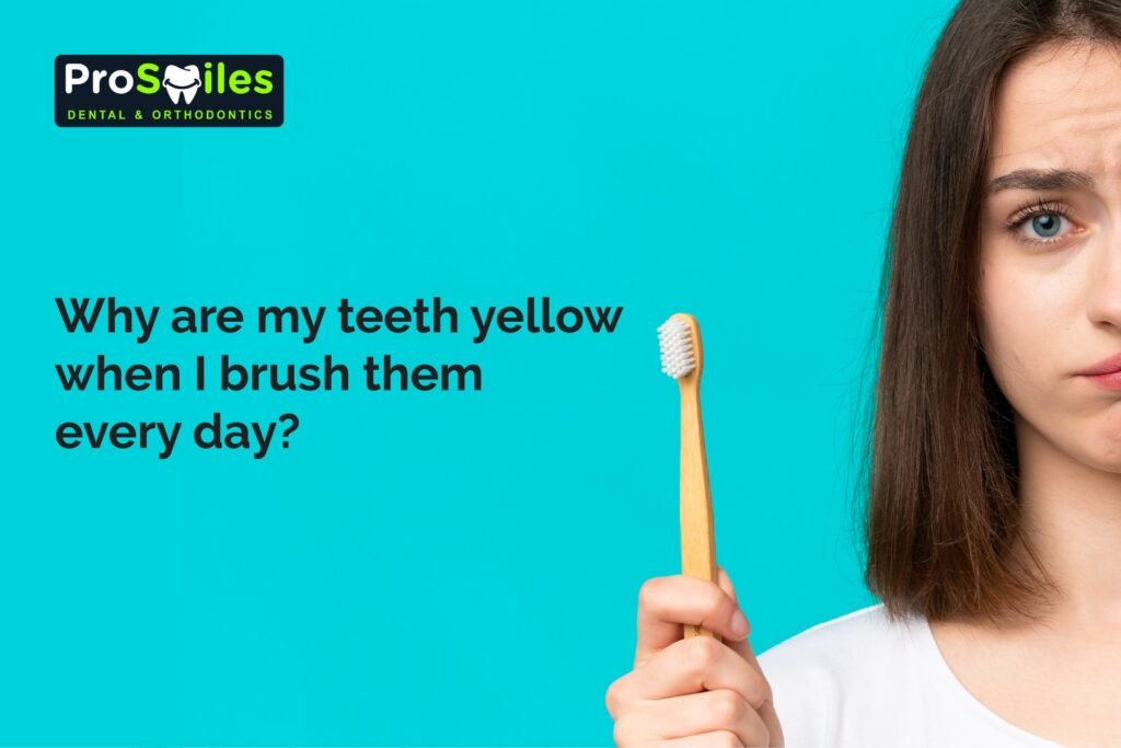yellow teeth