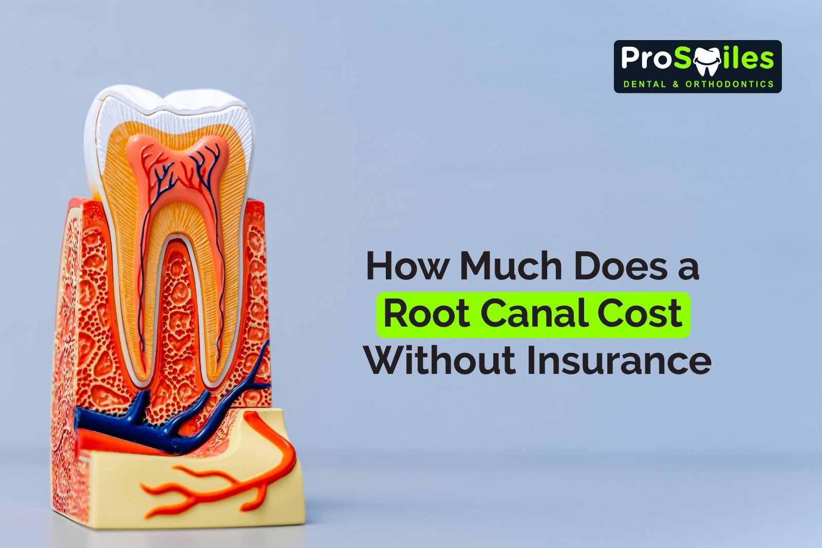 Root Canal Cost Without Insurance