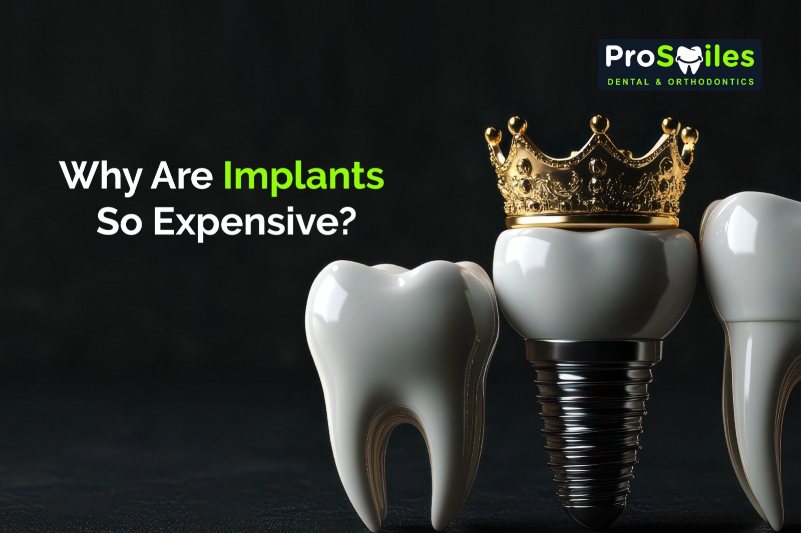 Why Are Implants So Expensive