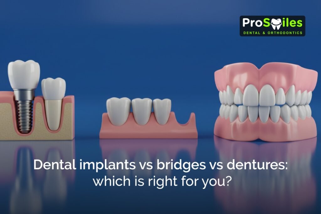 Dental implants vs Bridges vs Dentures