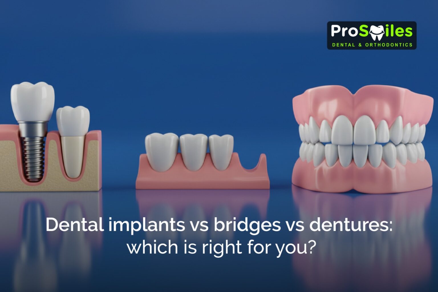 Dental implants vs Bridges vs Dentures: Which is right for you? — ProSmiles