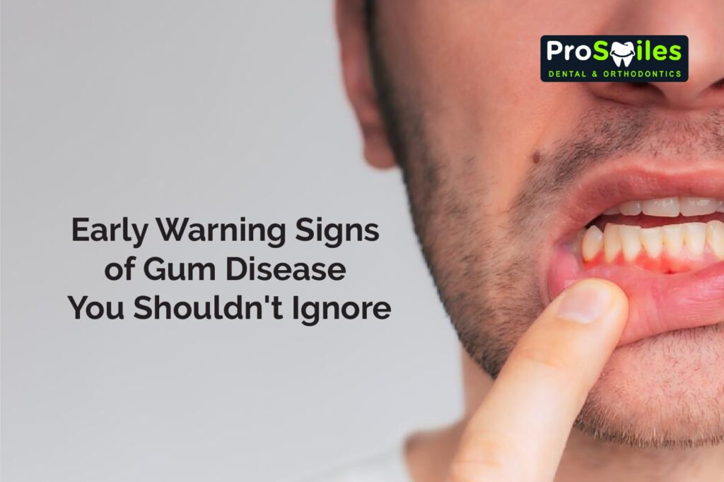 Warning Signs of Gum Disease
