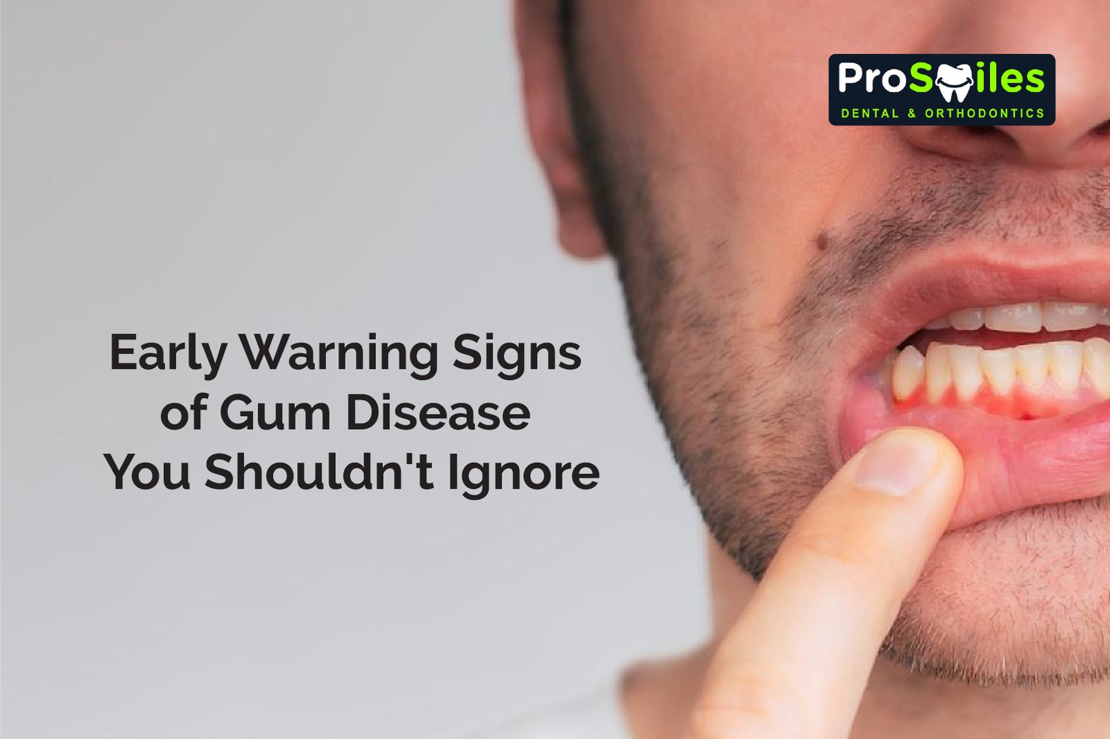 Early Warning Signs of Gum Disease You Shouldn’t Ignore