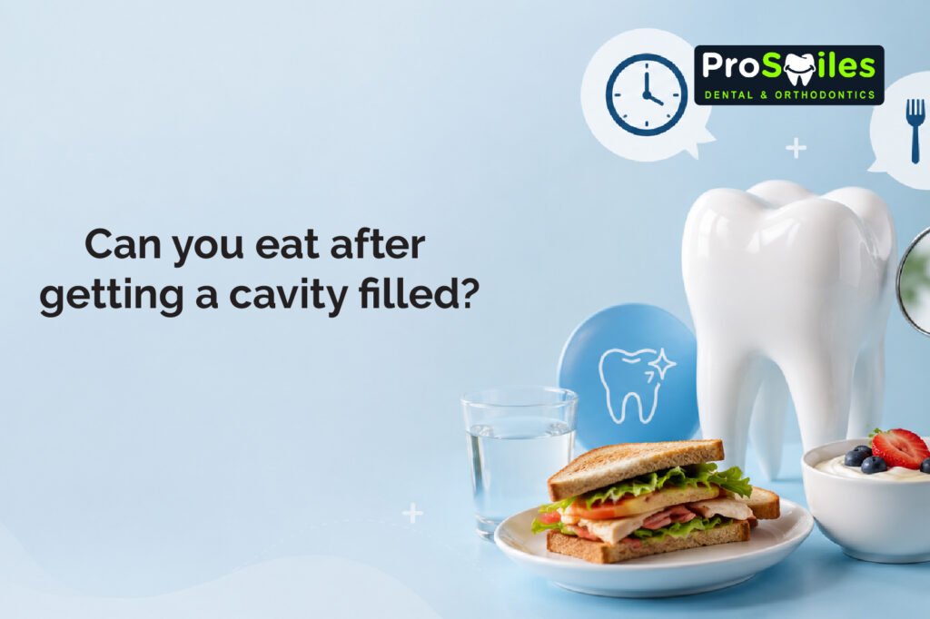 Can You Eat After Getting a Cavity Filled