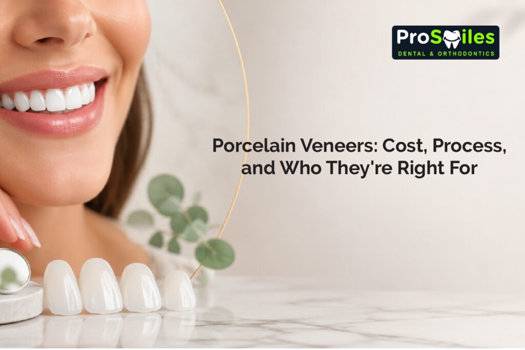 Porcelain Veneers